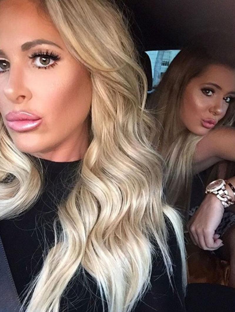 //kim zolciak brielle biermann plastic surgery