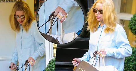 Iggy Azalea ASAP Rocky Finger Tattoos Removed