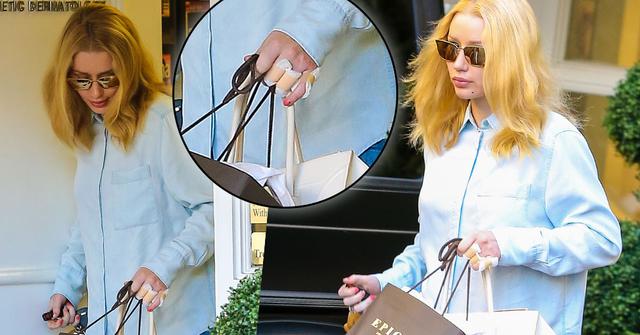 Iggy Azalea ASAP Rocky Finger Tattoos Removed