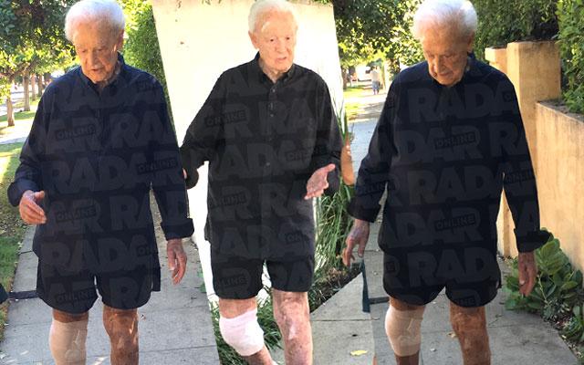 Bob Barker Bruised Battered After Accident