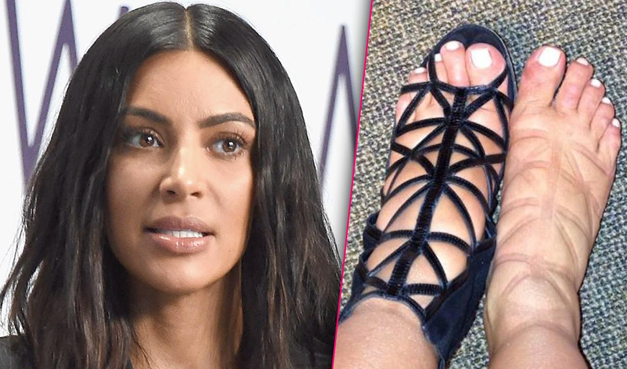 Inside Kim Kardashian's Secret Plastic Surgery Plan To Cure Her Cankles!(02)
