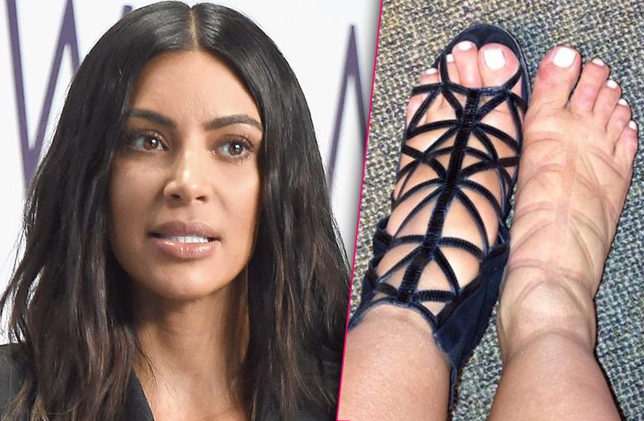 Inside Kim Kardashian's Secret Plastic Surgery Plan To Cure Her Cankles!
