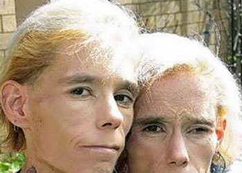 //anorexic twins die fire together