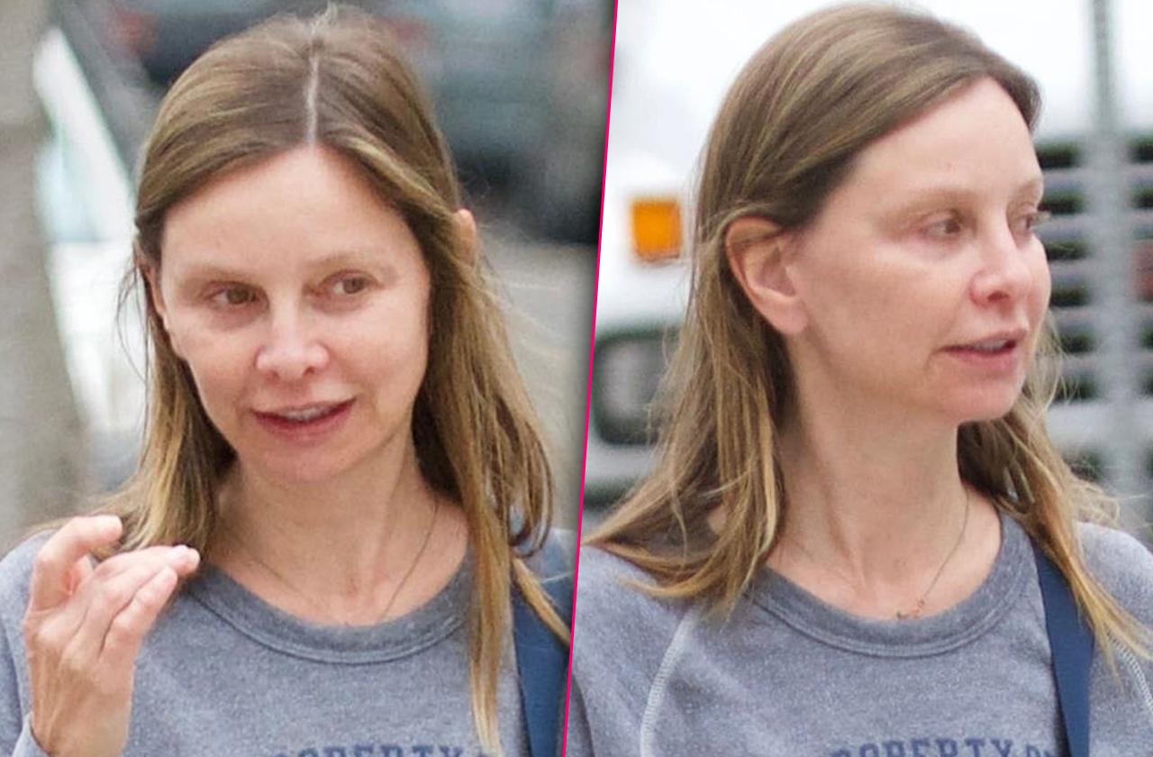 //calista flockhart plastic surgery before after pp