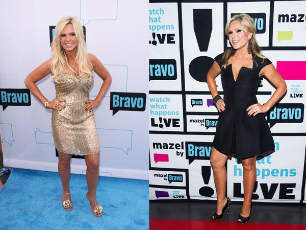 //real housewives plastic surgery secrets revealed