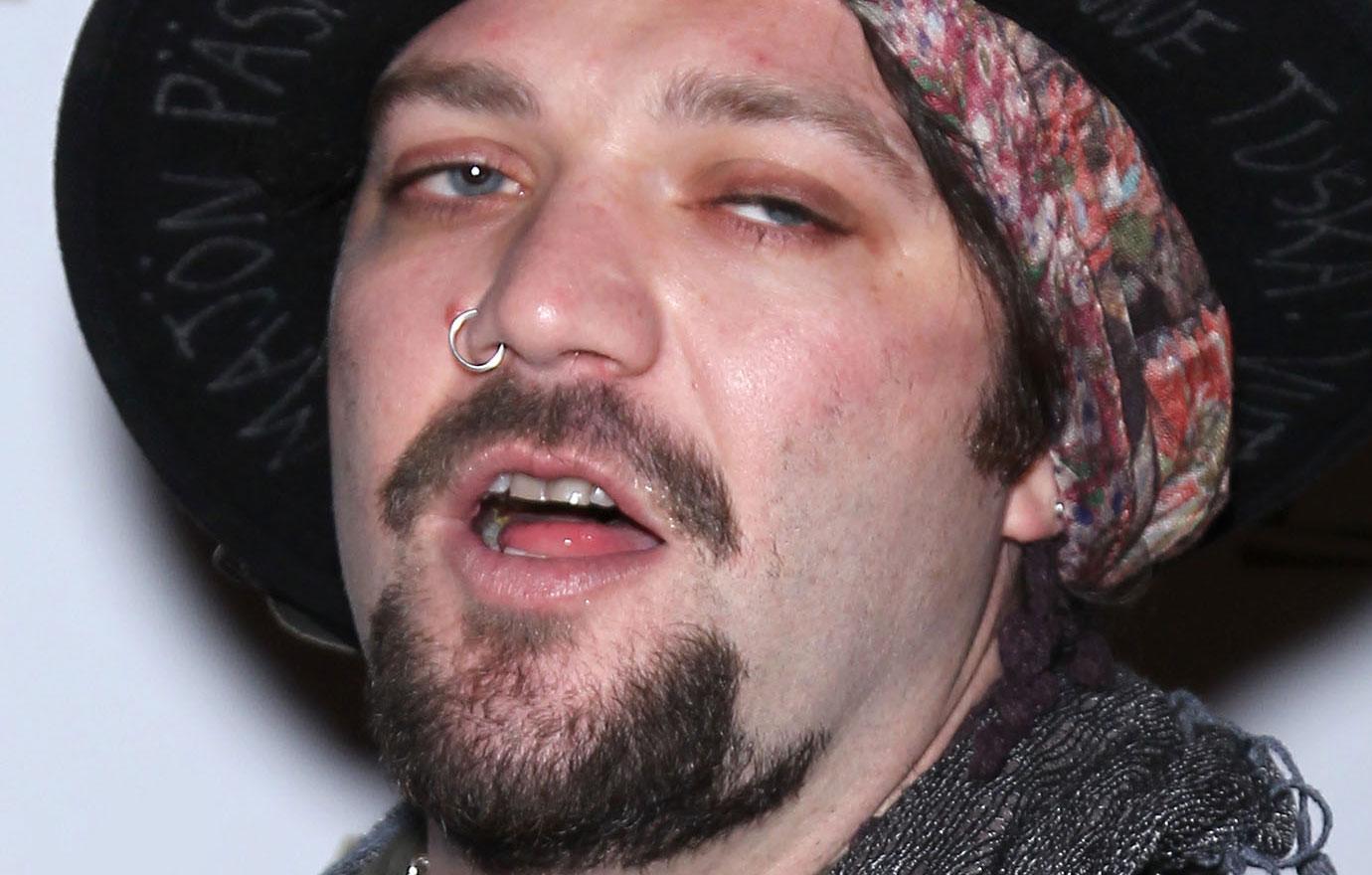 Former Jackass Star Bam Margera Not Doing Well