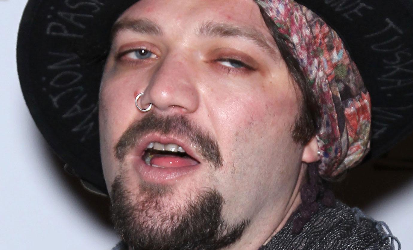 Former Jackass Star Bam Margera Not Doing Well