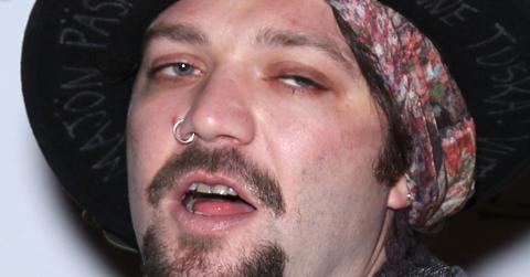 Former Jackass Star Bam Margera Not Doing Well