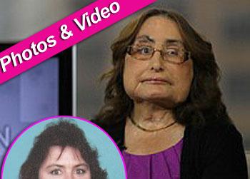 //connie culp face transplant anderson cooper