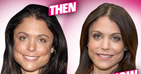 //Bethenny Frankel Plastic Surgery Transformation pp