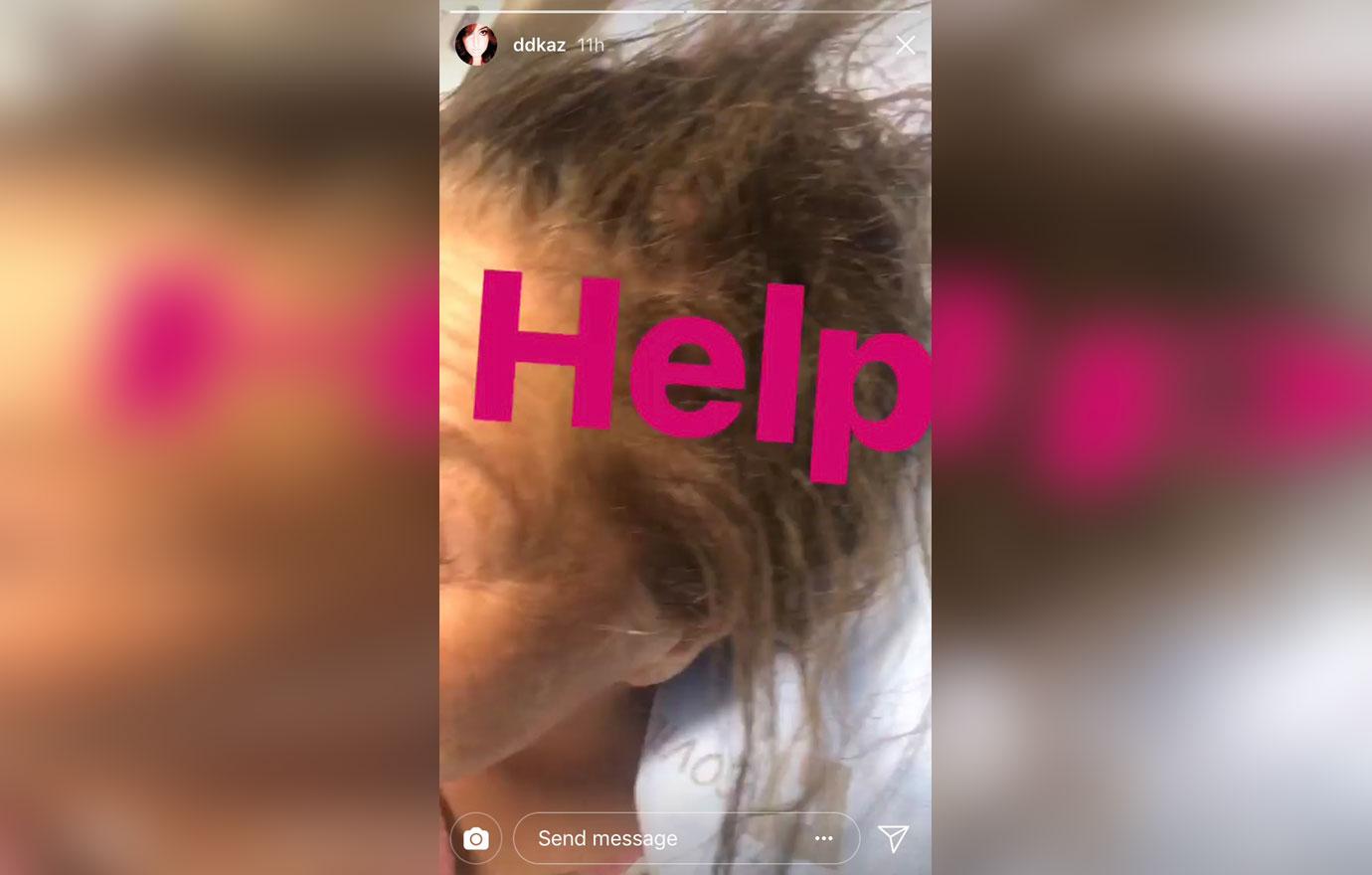 abby lee miller hair falling out cancer chemo