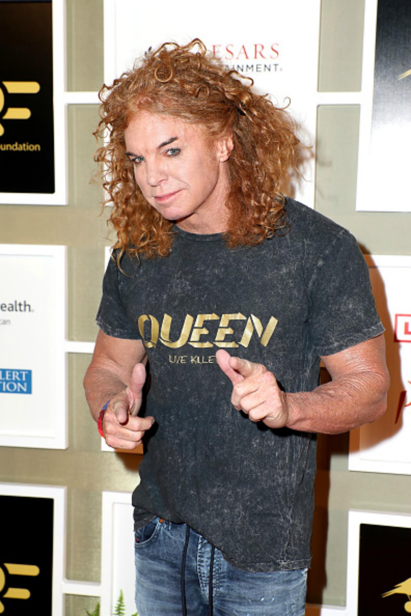 Carrot top transgender