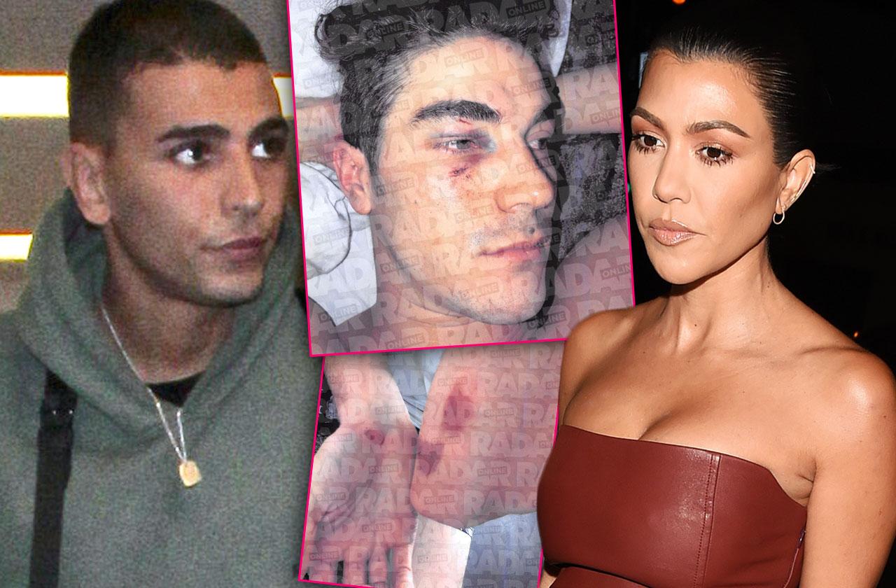 //Kourtney Kardashian Ex Younes Bendjima Threatened With Lawsuit After Nightclub Assault pp