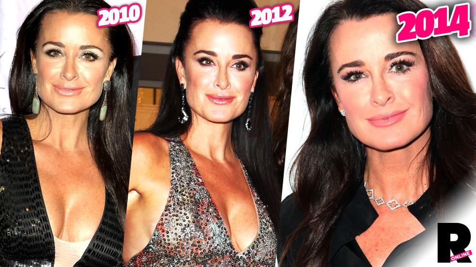 Fans Beg Kyle Richards to Stop Getting Plastic Surgery