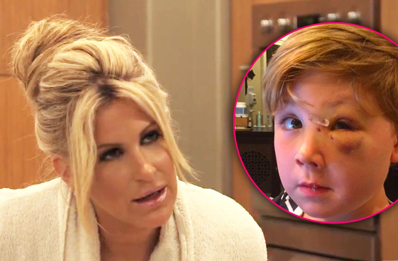 kim zolciak son kash biermann dog bite plastic surgery plays animals video