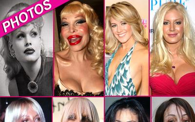 //surgery before after wenngetty post