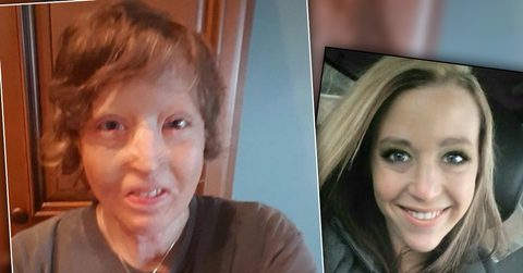 //burned mom transformation photos pp