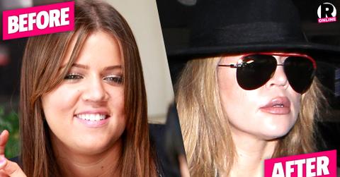 khloe kardashian plastic surgery