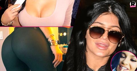 Kylie Jenner Plastic Surgery