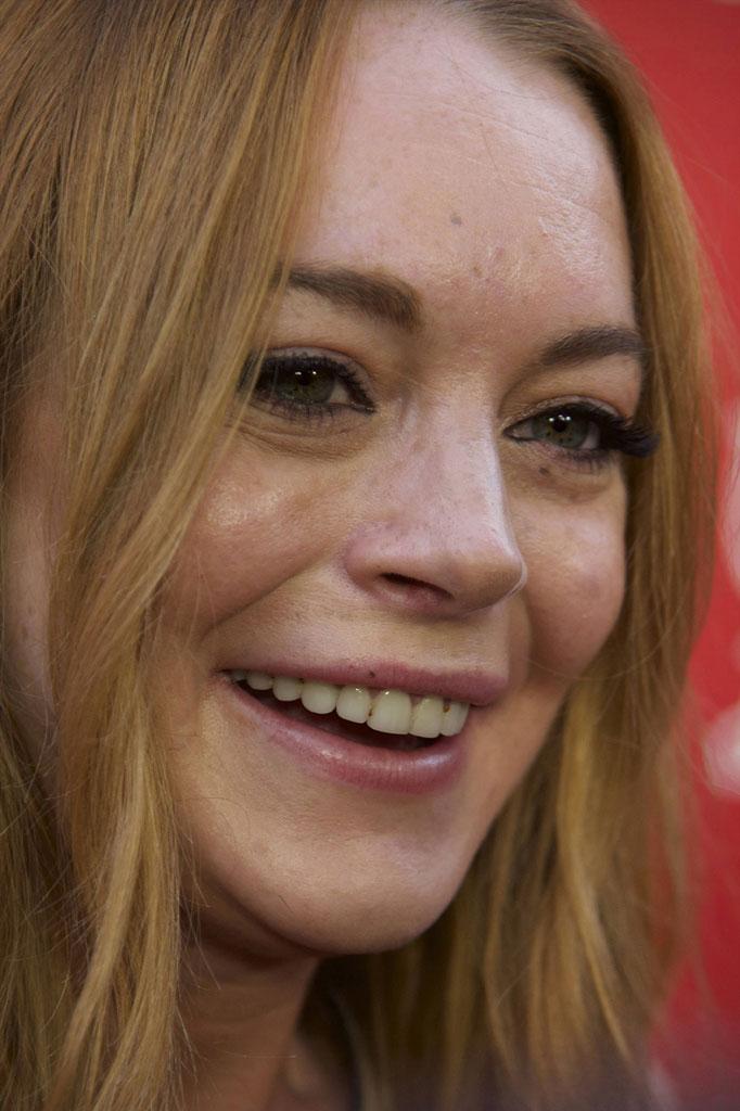 Lindsay Lohan Teeth Rotted Bad 02 