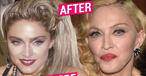 Exclusive Madonna Plastic Surgery Secrets Revealed