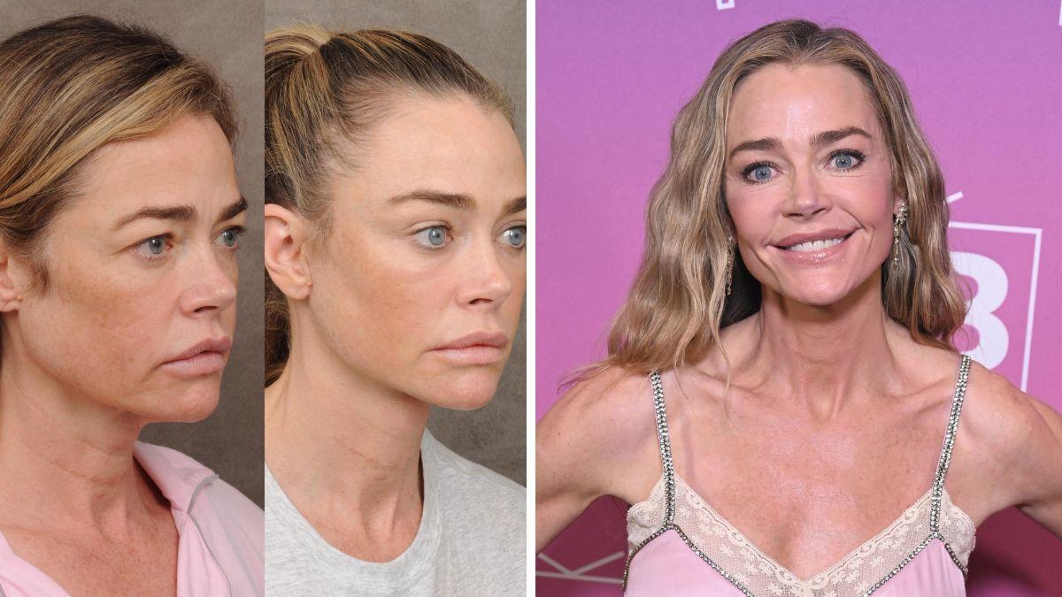 Photo of Denise Richards