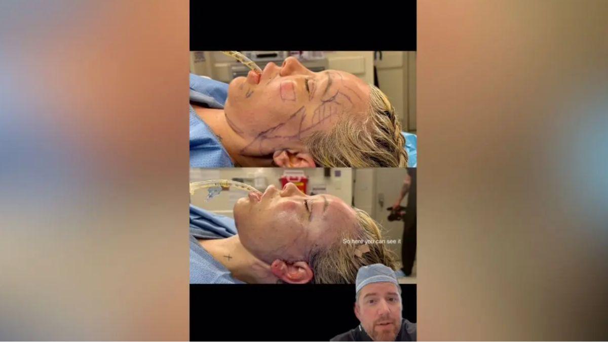 image of Bunnie Xo praised Dr. Gould's work on Instgram.