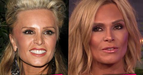 tamra judge plastic surgery face lift rhoc wwhl pics