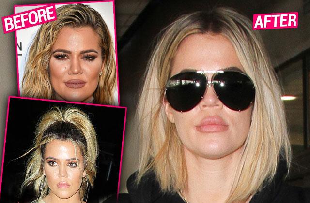 khloe kardashian plastic surgery lips face