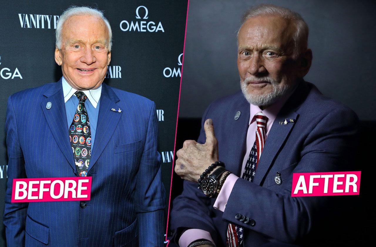 Buzz Aldrin before and after the face-lift.