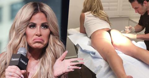kim zolciak butt thong cellulite treatment