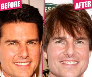 //tom cruise jameson empire awards new look botox puffy pillow tall