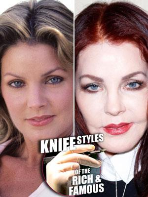 //priscilla presley dramatic plasic surgery transformation tall