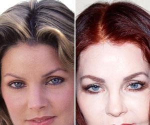 //priscilla presley dramatic plasic surgery transformation tall