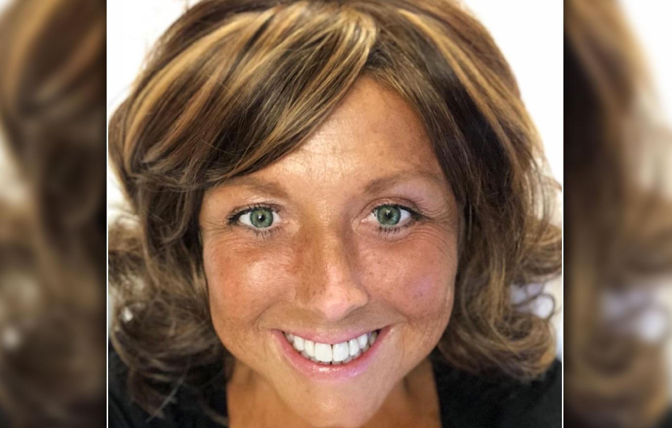 Abby Lee Miller Shows Off Scars, Removes Wig During Cancer: Pics