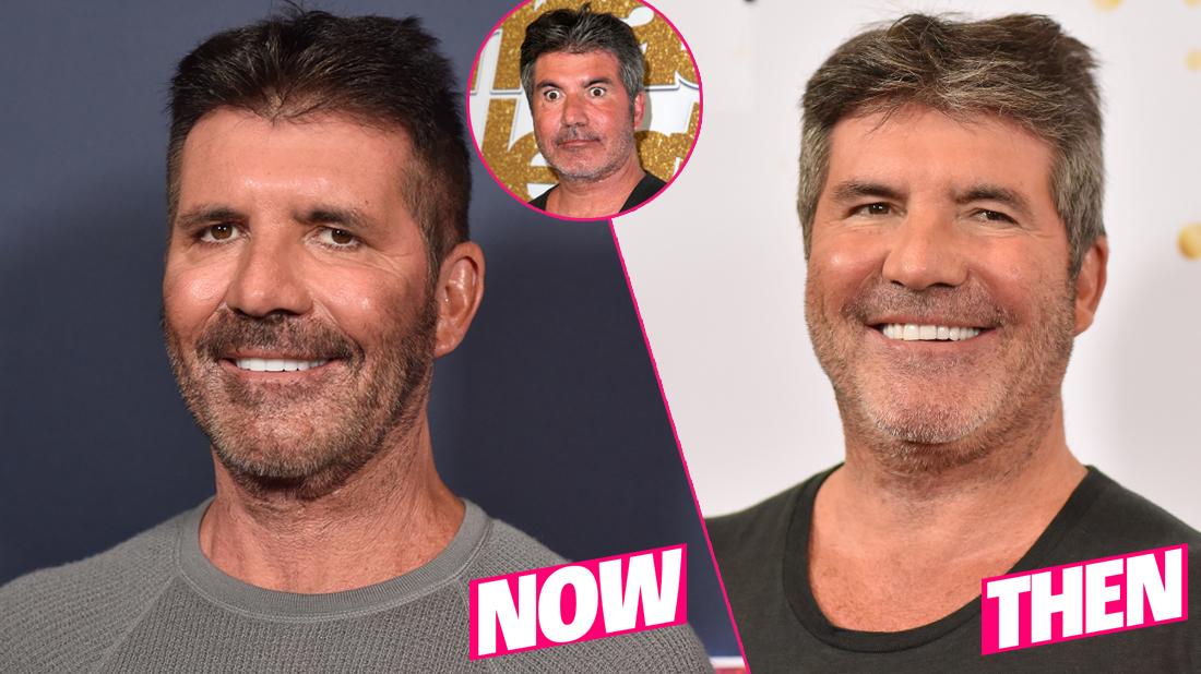 Simon Cowell Before And After: A Journey Through Transformation