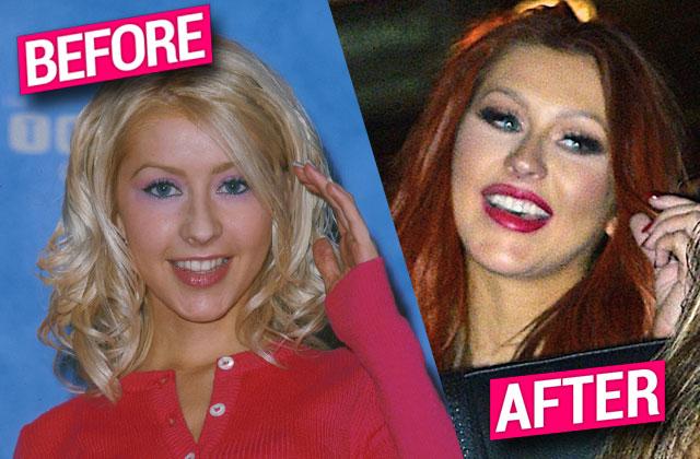 christina aguilera plastic surgery face cheek filler implants nose job