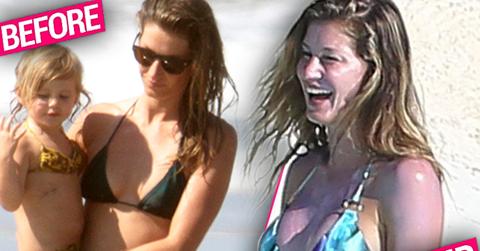 Gisele Bundchen Bikini Plastic Surgery Photos