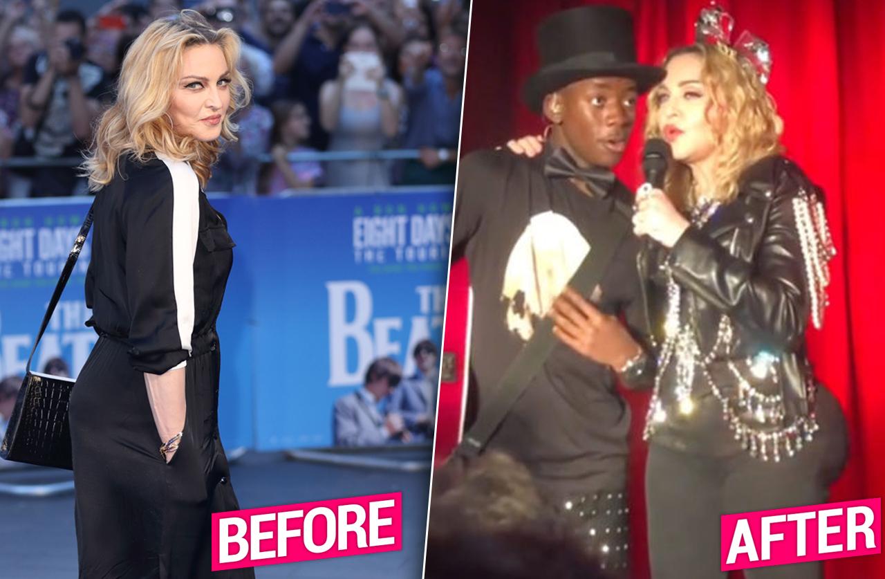 Madonna Risks Life For New Butt Implant, Docs Claim