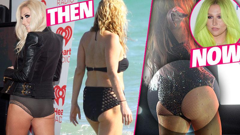 Kesha Butt Implants