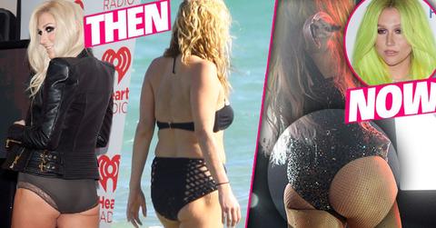 Kesha Butt Implants