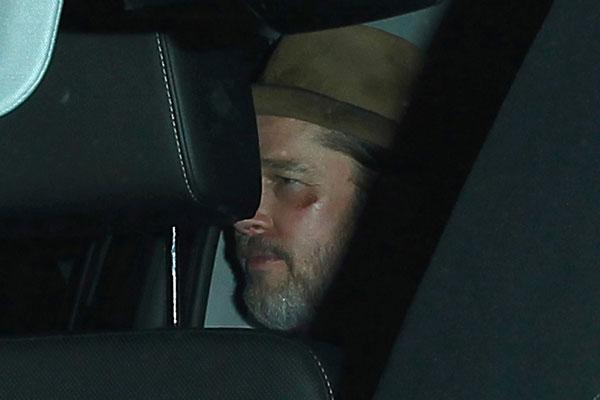 Brad Pitt Bruised Face