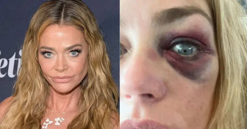 denise richards divorce aaron phypers rhobh spotlight