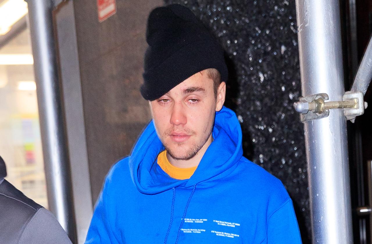 Justin Bieber Looks Rough In New York