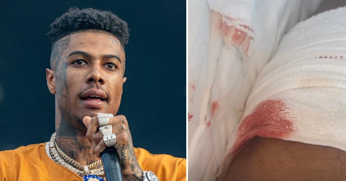 Watch the Video Blueface Stabbed During Confrontation at Gym 