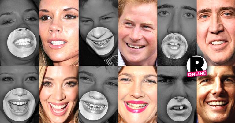 They May Be Beautiful But These Celebs Were Given A Bad Set Of Chompers 