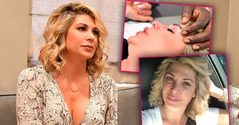 Alexis Bellino, Shocking Photos Of ‘RHOC’ Star Alexis Bellino Getting Plastic Surgery After Brutal Black Eye