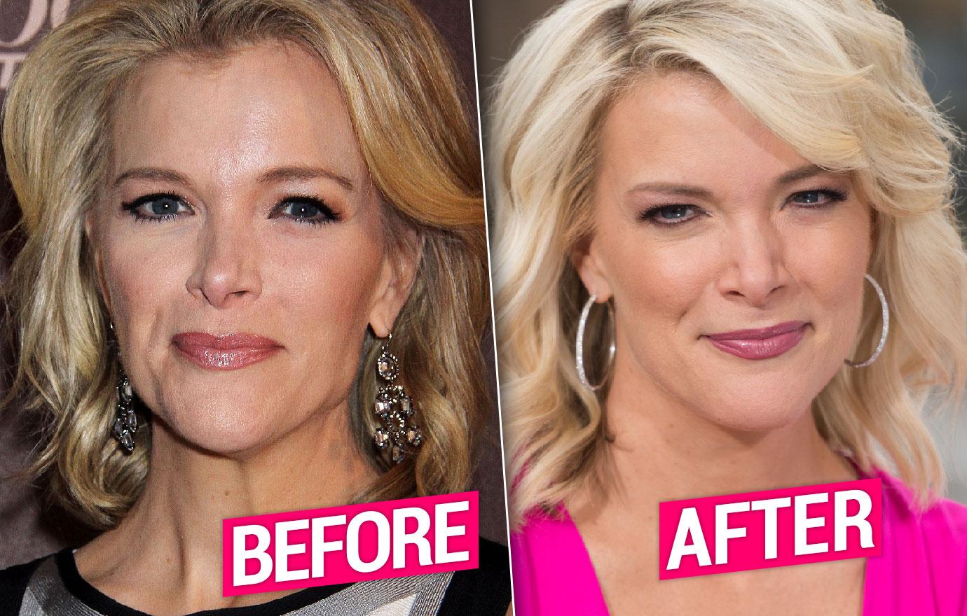 //megyn kelly secrets and scandals pp