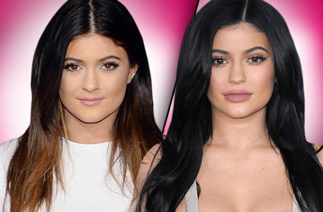 //Kylie Jenner Plastic Surgery Makeover pp