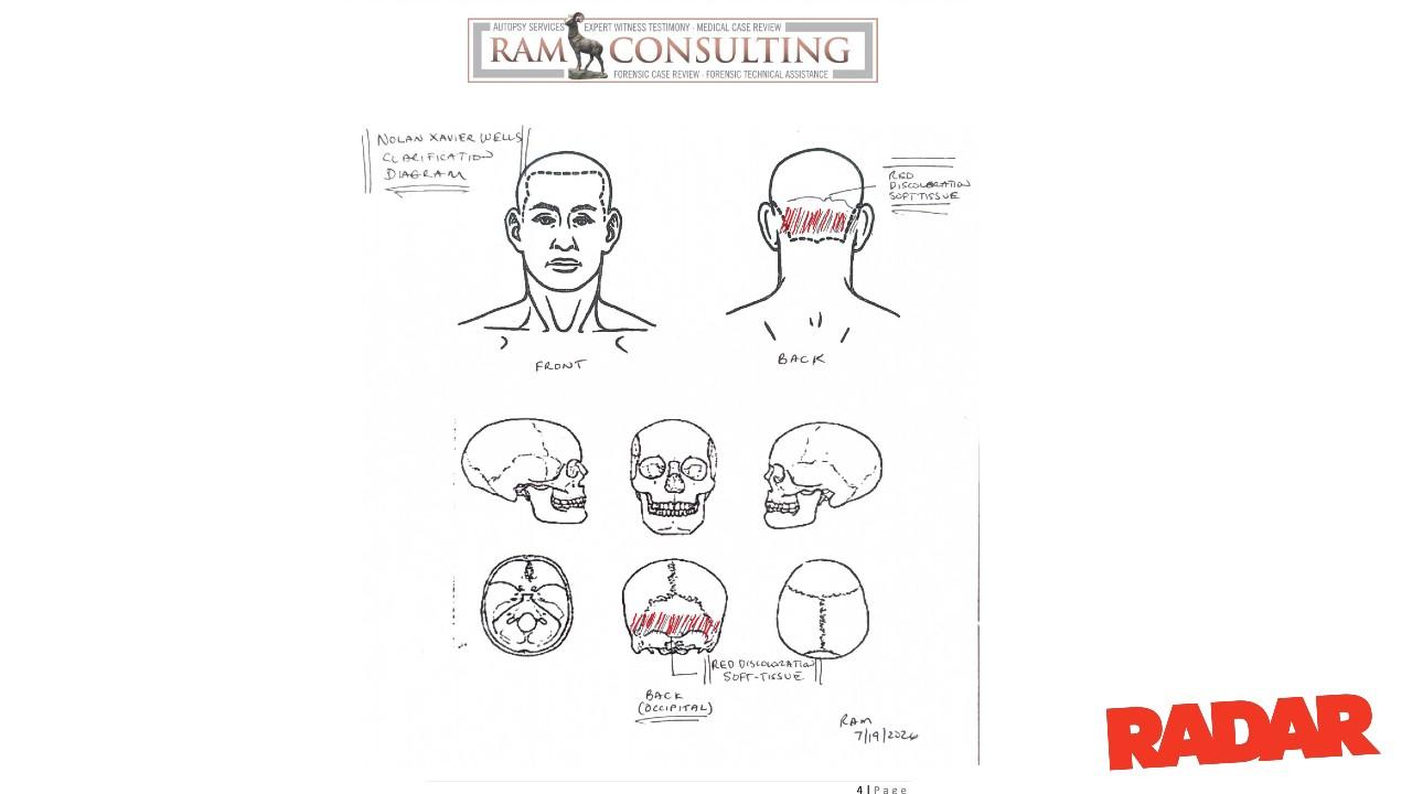 The independent autopsy report found some bruising on Wells' head.
